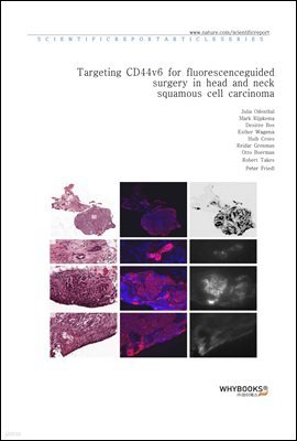 Targeting CD44v6 for fluorescence-guided surgery in head and neck squamous cell carcinoma