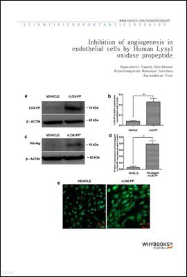 Inhibition of angiogenesis in endothelial cells by Human Lysyl oxidase propeptide