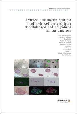 Extracellular matrix scaffold and hydrogel derived from decellularized and delipidized human pancreas