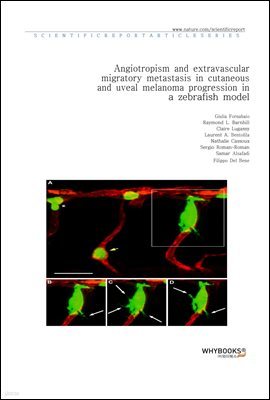 Angiotropism and extravascular migratory metastasis in cutaneous and uveal melanoma progression in a zebrafish model