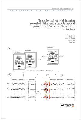 Transdermal optical imaging revealed different spatiotemporal patterns of facial cardiovascular activities