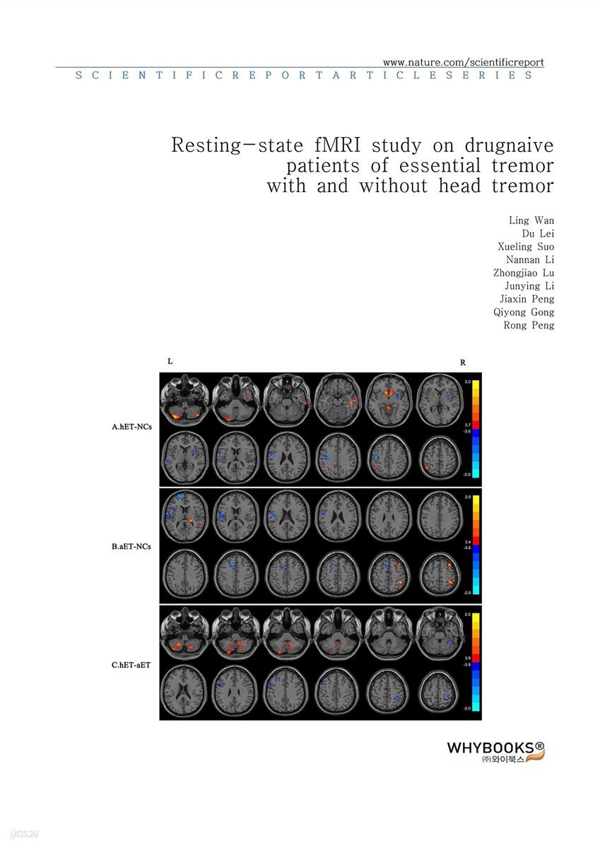 Resting-state fMRI study on drug-naive patients of essential tremor with and without head tremor