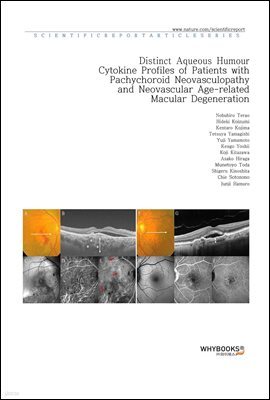 Distinct Aqueous Humour Cytokine Profiles of Patients with Pachychoroid Neovasculopathy and Neovascular Age-related Macular Degeneration