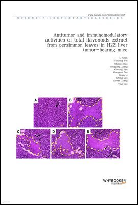 Antitumor and immunomodulatory activities of total flavonoids extract from persimmon leaves in H22 liver tumor-bearing mice