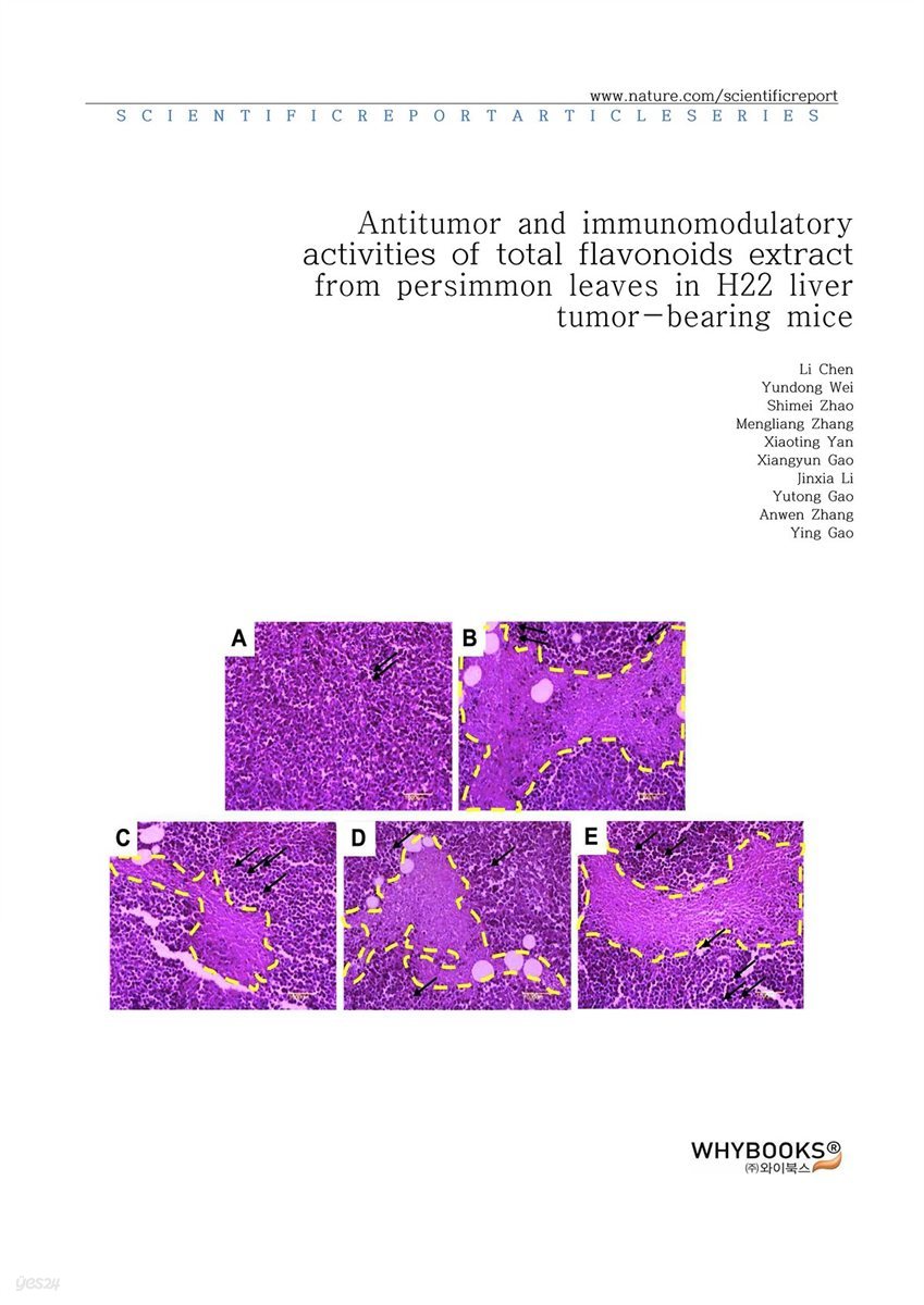 Antitumor and immunomodulatory activities of total flavonoids extract from persimmon leaves in H22 liver tumor-bearing mice