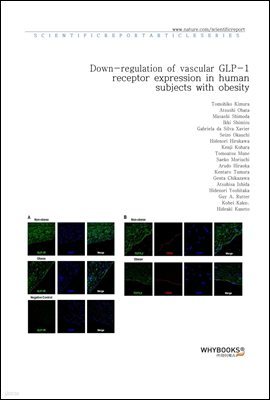 Down-regulation of vascular GLP-1 receptor expression in human subjects with obesity