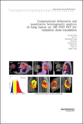 Computational delineation and quantitative heterogeneity analysis of lung tumor on 18F-FDG PET for radiation dose-escalation