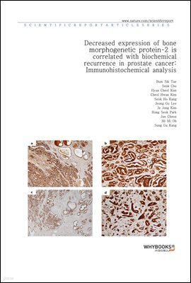 Decreased expression of bone morphogenetic protein-2 is correlated with biochemical recurrence in prostate cancer Immunohistochemical analysis