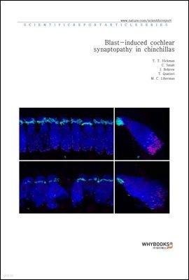 Blast-induced cochlear synaptopathy in chinchillas