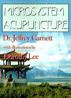 Microsystem Acupuncture