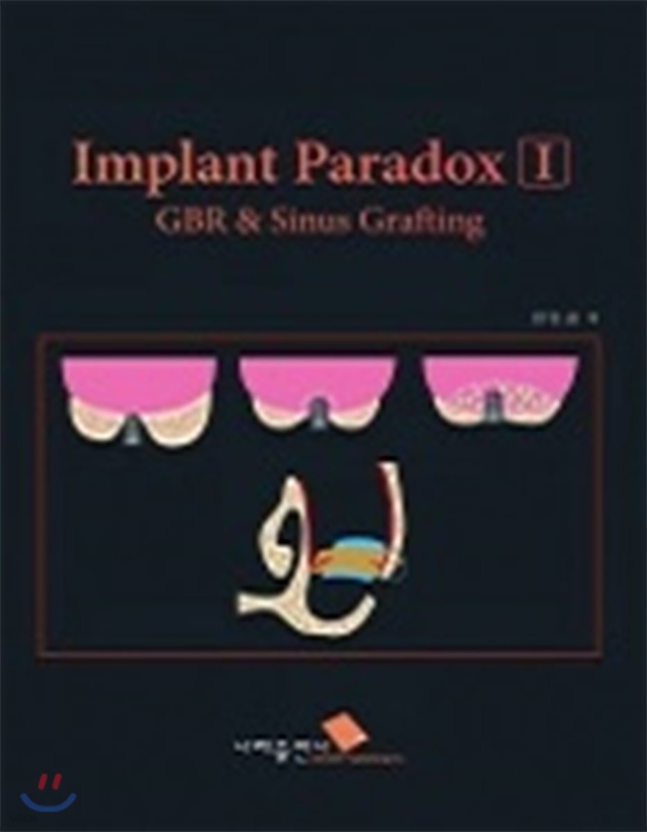 Implant Paradox I GBR &amp; Sinus Grafting