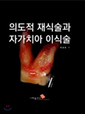 의도적 재식술과 자가치아이식술