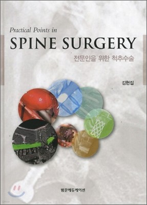 Spine Surgery