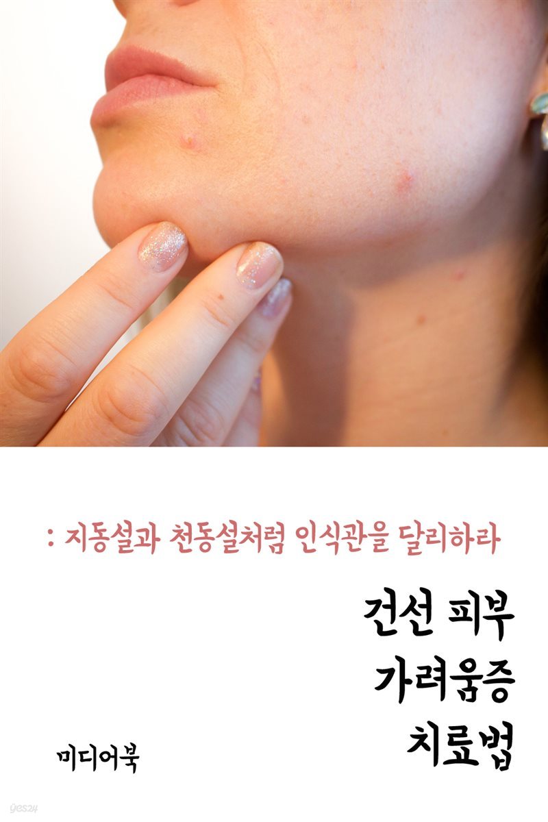 건선 피부 가려움증 치료법 : 지동설과 천동설처럼 인식관을 달리하라