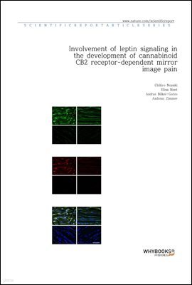 Involvement of leptin signaling in the development of cannabinoid CB2 receptor-dependent mirror image pain