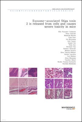 Exosome-associated Shiga toxin 2 is released from cells and causes severe toxicity in mice