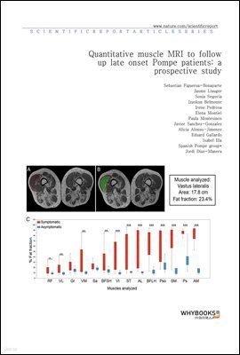 Quantitative muscle MRI to follow up late onset Pompe patients a prospective study