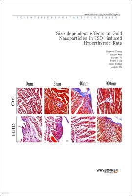 Size dependent effects of Gold Nanoparticles in ISO-induced Hyperthyroid Rats