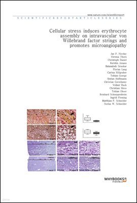 Cellular stress induces erythrocyte assembly on intravascular von Willebrand factor strings and promotes microangiopathy