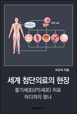 세계 첨단의료의 현장 : 줄기세포(iPS세포) 치료 어디까지 왔나