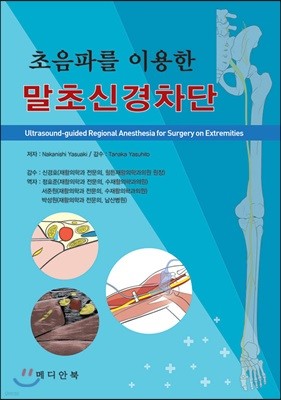 초음파를 이용한 말초신경차단