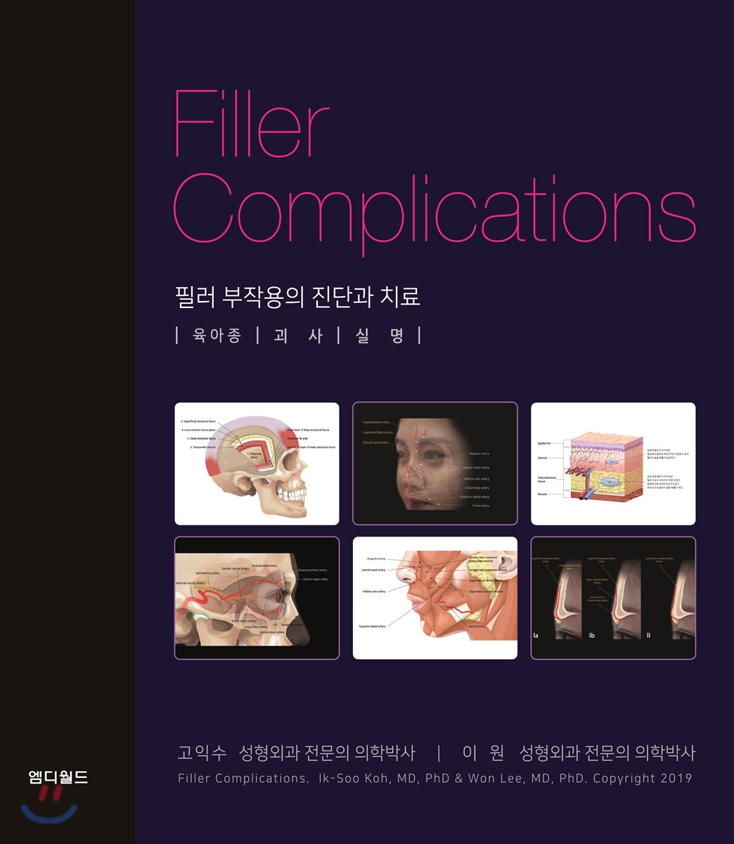 필러 부작용의 진단과 치료
