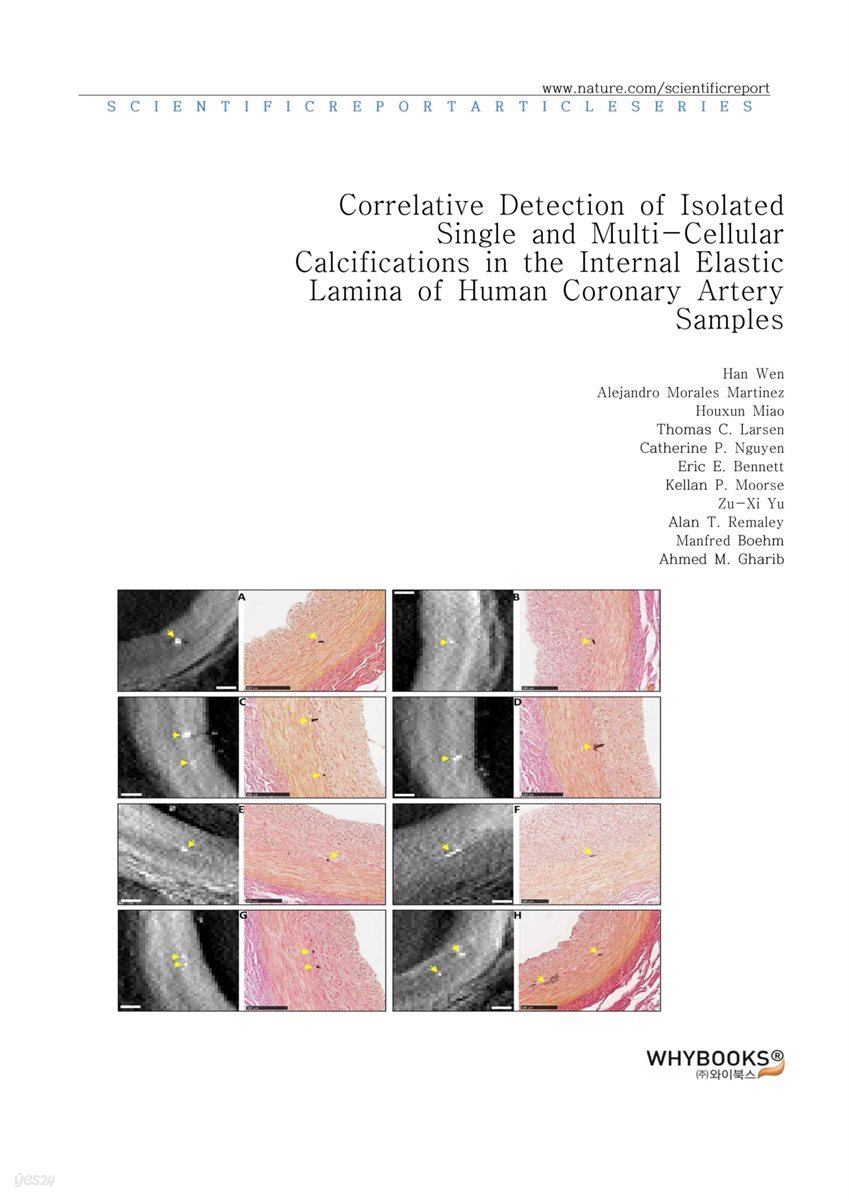 Correlative Detection of Isolated Single and Multi-Cellular Calcifications in the Internal Elastic Lamina of Human Coronary Artery Samples