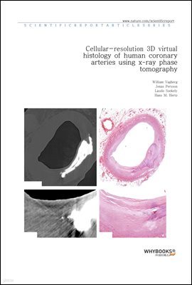 Cellular-resolution 3D virtual histology of human coronary arteries using x-ray phase tomography