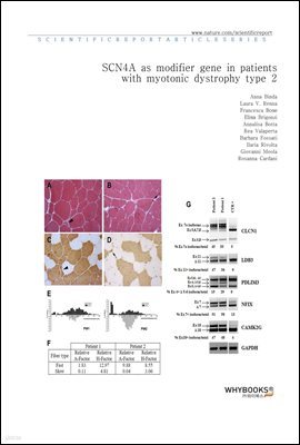 SCN4A as modifier gene in patients with myotonic dystrophy type 2