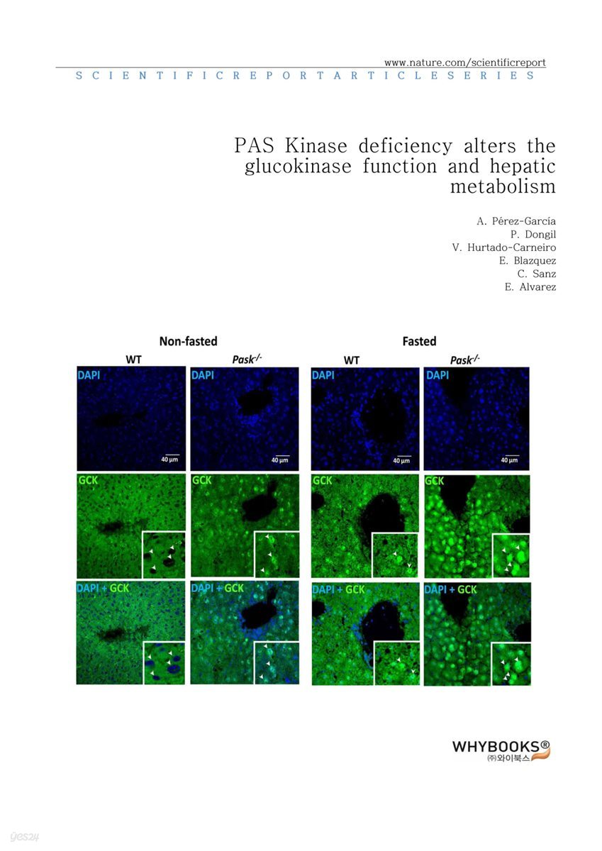 PAS Kinase deficiency alters the glucokinase function and hepatic metabolism