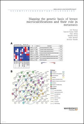 Mapping the genetic basis of breast microcalcifications and their role in metastasis