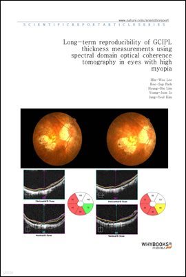 Long-term reproducibility of GC-IPL thickness measurements using spectral domain optical coherence tomography in eyes with high myopia