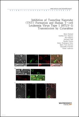 Inhibition of Tunneling Nanotube (TNT) Formation and Human T-cell Leukemia Virus Type 1 (HTLV-1) Transmission by Cytarabine