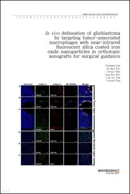 In vivo delineation of glioblastoma by targeting tumor-associated macrophages with near-infrared fluorescent silica coated iron oxide nanoparticles in orthotopic xenografts for surgical guidance