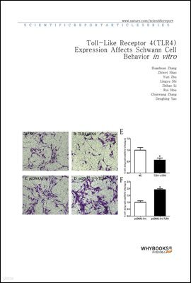 Toll-Like Receptor 4 (TLR4) Expression Affects Schwann Cell Behavior in vitro