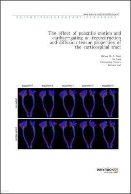 The effect of pulsatile motion and cardiac-gating on reconstruction and diffusion tensor properties of the corticospinal tract