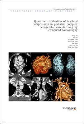 Quantified evaluation of tracheal compression in pediatric complex congenital vascular ring by computed tomography