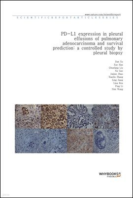 PD-L1 expression in pleural effusions of pulmonary adenocarcinoma and survival prediction a controlled study by pleural biopsy