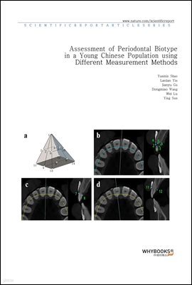 Assessment of Periodontal Biotype in a Young Chinese Population using Different Measurement Methods