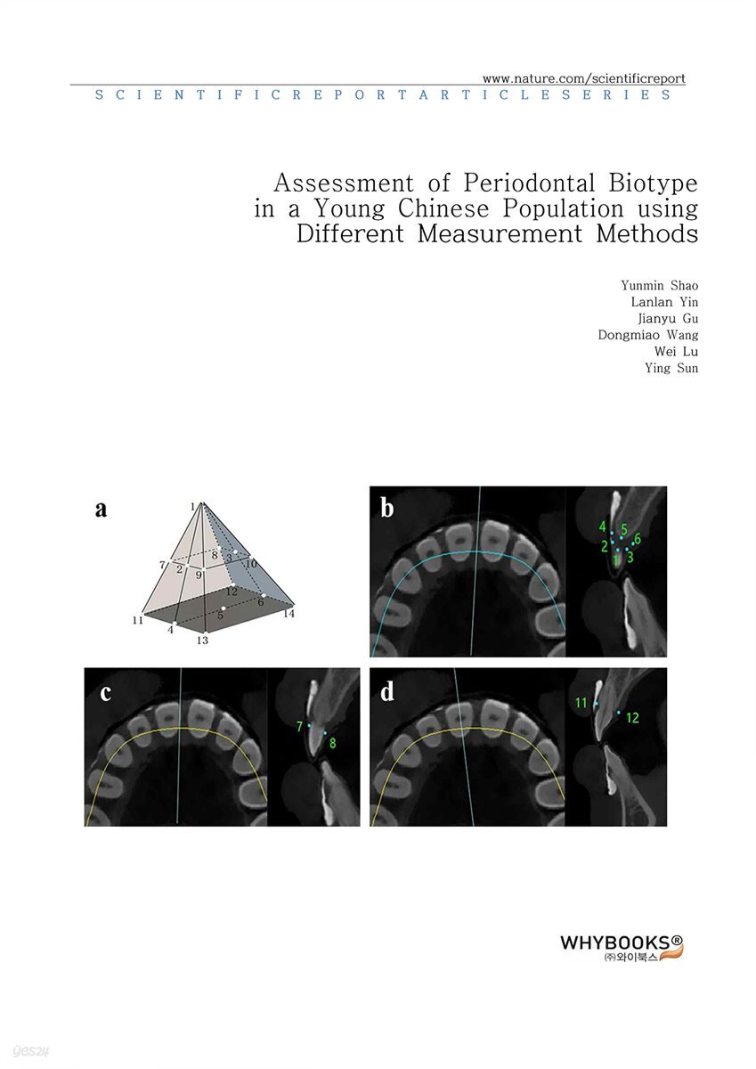 Assessment of Periodontal Biotype in a Young Chinese Population using Different Measurement Methods