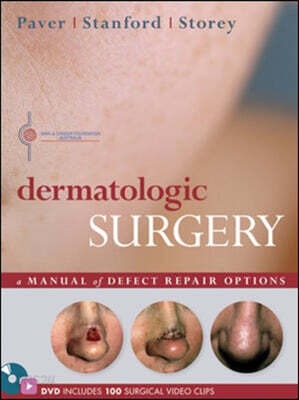 Dermatologic Surgery