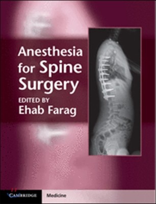 Anesthesia for Spine Surgery