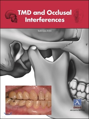 TMD and Occlusal Interferences