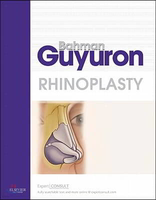 Rhinoplasty