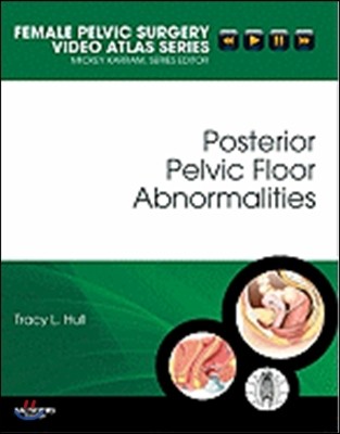 Posterior Pelvic Floor Abnormalities