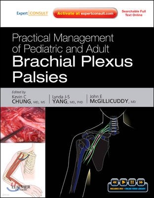 Practical Management of Pediatric and Adult Brachial Plexus