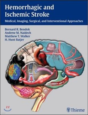 Hemorrhagic and Ischemic Stroke: Medical, Imaging, Surgical and Interventional Approaches [With Web Access]