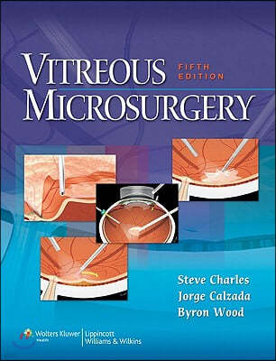 Vitreous Microsurgery