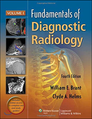 Fundamentals of Diagnostic Radiology - 4 Volume Set