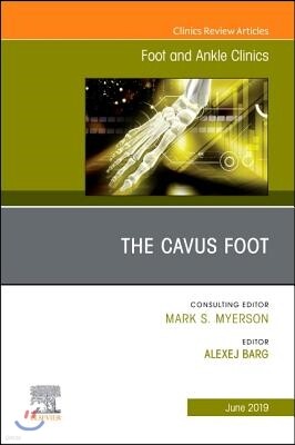 Elsevier Health Sciences The Cavus Foot, an Issue of Foot and Ankle Clinics of North America: Volume 24-2